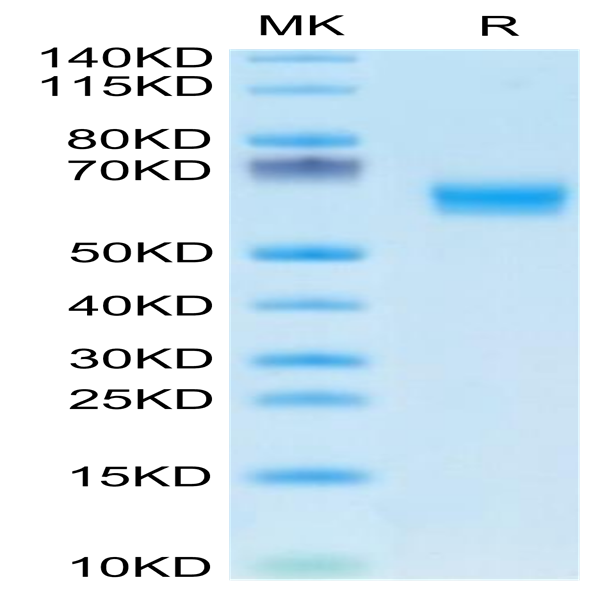 Human DDR1 Protein (DDR-HM1R1)