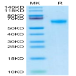 Human DDR2 Protein (DDR-HM1R2)