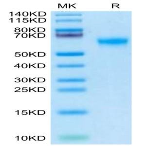 Human DDR2 Protein (DDR-HM1R2)