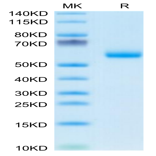 Mouse DDR1 Protein (DDR-MM1R1)