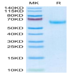 Mouse DDR2 Protein (DDR-MM1R2)