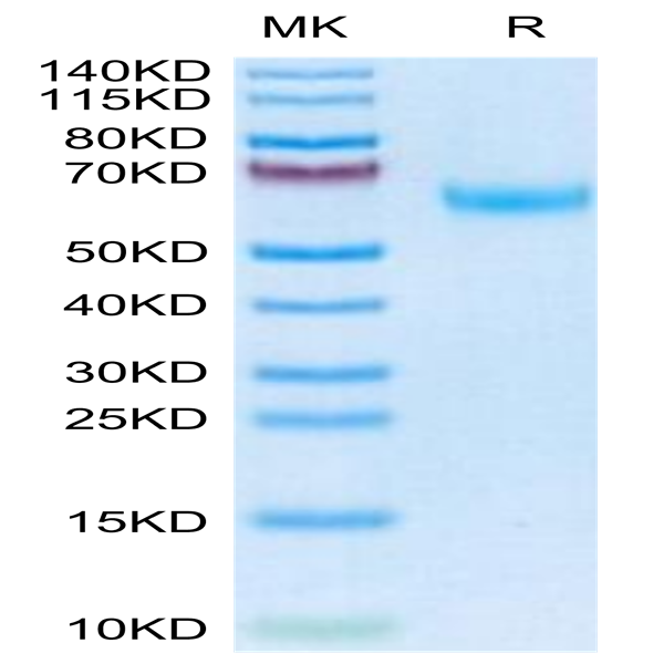 Mouse DDR2 Protein (DDR-MM1R2)