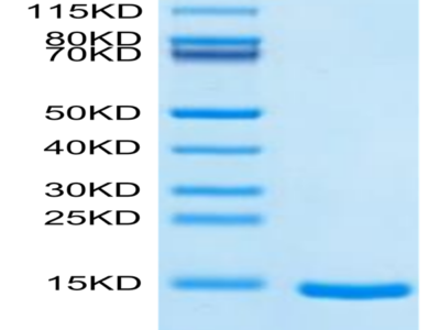 Cynomolgus DDT Protein (DDT-CE101)