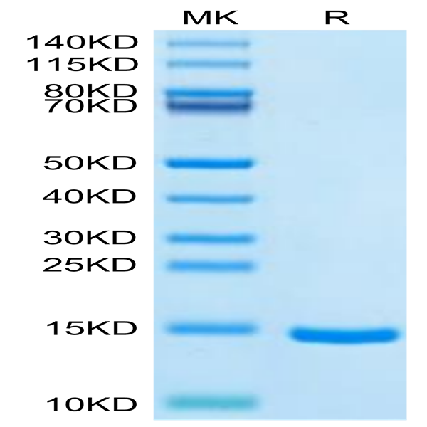 Cynomolgus DDT Protein (DDT-CE101) Cynomolgus DDT Protein (DDT-CE101)