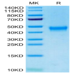 Cynomolgus/Rhesus macaque DKK1 Protein (DKK-CM101)
