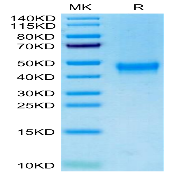 Cynomolgus/Rhesus macaque DKK1 Protein (DKK-CM101)