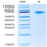 Cynomolgus/Rhesus macaque DKK1 Protein (DKK-CM301)