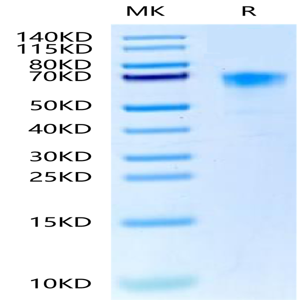 Cynomolgus/Rhesus macaque DKK1 Protein (DKK-CM301)