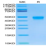 Human DKK1 Protein (DKK-HM101)