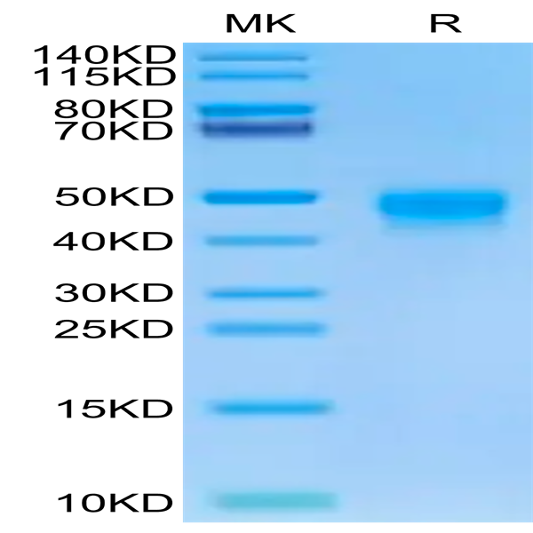 Human DKK1 Protein (DKK-HM101)