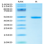 Human DKK1 C terminal Domain Protein (DKK-HM31C)