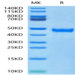 Human DKK1 N terminal Domain Protein (DKK-HM31N)