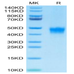 Biotinylated Human DKK1 Protein (DKK-HM401B)