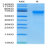 Human DKK3 Protein (DKK-HM403)