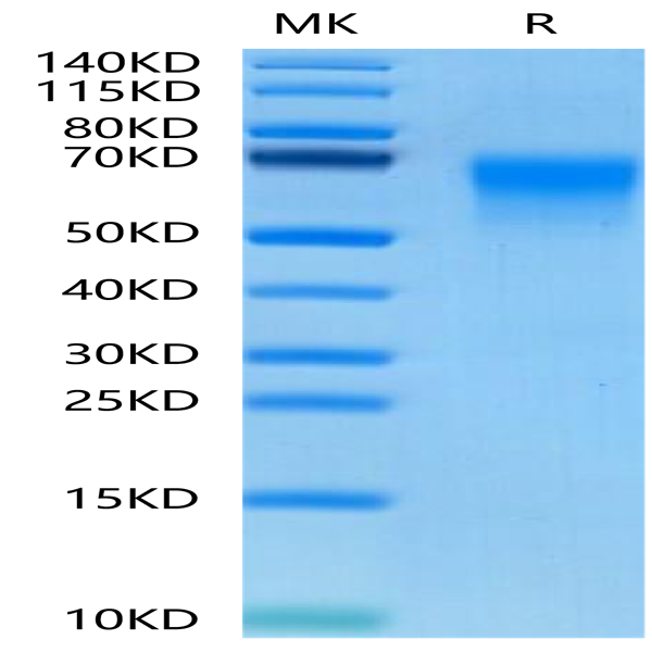 Human DKK3 Protein (DKK-HM403)