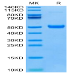 Human DKK1 C terminal Domain Protein (DKK-HM51C)