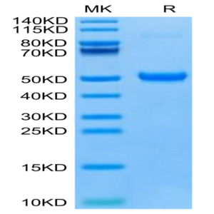 Human DKK1 C terminal Domain Protein (DKK-HM51C)