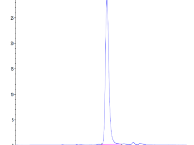 Human DLK1 Protein (DLK-HM101)