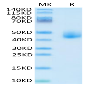 Human DLK1 Protein (DLK-HM101)