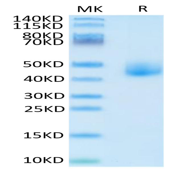 Human DLK1 Protein (DLK-HM101)