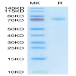 Human DLK1 Protein (DLK-HM201)