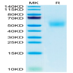 Mouse DLK1 Protein (DLK-MM101)