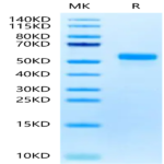 Biotinylated Human DLL3 Protein (Primary Amine Labeling) (DLL-HM103B)