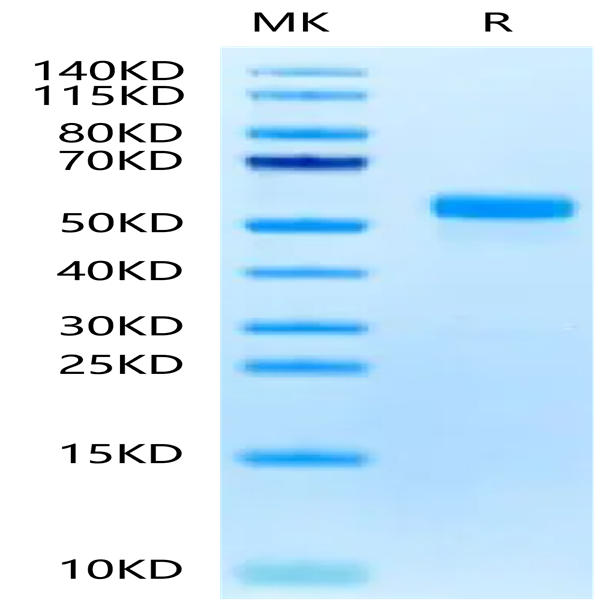 Biotinylated Human DLL3 Protein (Primary Amine Labeling) (DLL-HM103B)