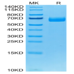 Human DLL4 Protein (DLL-HM404)
