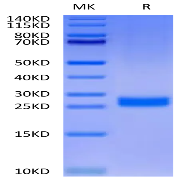 Human DLL3 Domain (311-479) Protein (DLL-HM4D1)