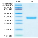 SARS-CoV-2 Spike RBD (Delta plus AY.1/AY.2) Protein (DP1-VM1BD)