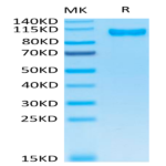 Human DPPIV/CD26 Protein (DPV-HM126)