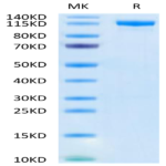 Human DPPIV/CD26 Protein (DPV-HM226)