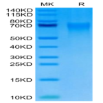 Cynomolgus DR6/TNFRSF21 Protein (DR6-CM101)