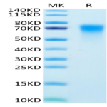 Human DR6/TNFRSF21 Protein (DR6-HM101)