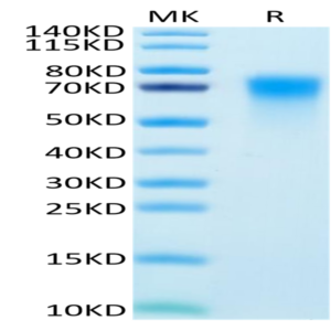 Human DR6/TNFRSF21 Protein (DR6-HM101)