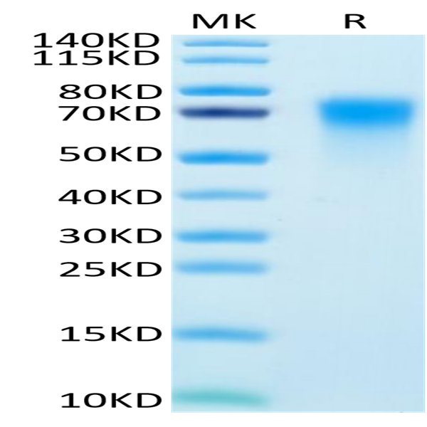 Human DR6/TNFRSF21 Protein (DR6-HM101)