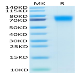 Mouse DR6/TNFRSF21 Protein (DR6-MM101)