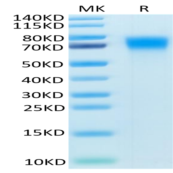 Mouse DR6/TNFRSF21 Protein (DR6-MM101) Mouse DR6/TNFRSF21 Protein (DR6-MM101)