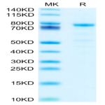 Mouse DSG-2/Desmoglein-2 Protein (DSG-MM102)