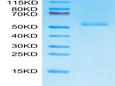 Monkeypox virus E8L Protein (E8L-VE18L)