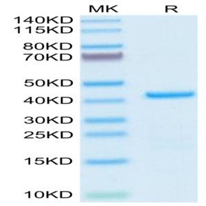 Human EMAP-II/AIMP1 Protein (EAP-HE102)
