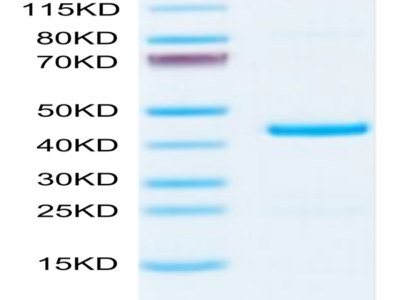 Mouse EMAP-II/AIMP1 Protein (EAP-ME102)