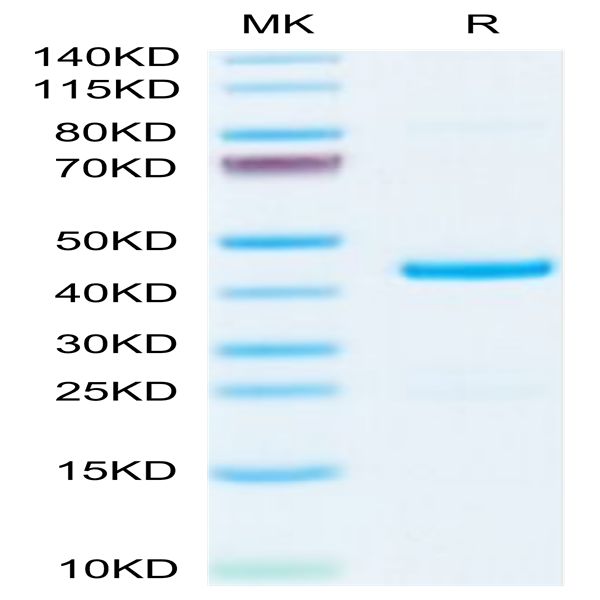 Mouse EMAP-II/AIMP1 Protein (EAP-ME102) Mouse EMAP-II/AIMP1 Protein (EAP-ME102)