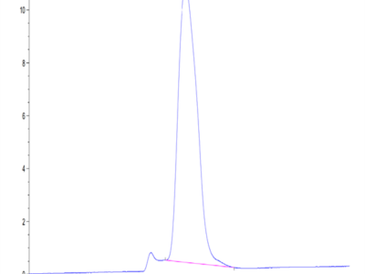 Human ECSCR Protein (ECS-HM201)