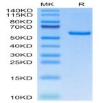 Human EDA2R Protein (EDA-HM22R)