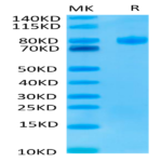 Human Endoglin/CD105 Protein (EDG-HM401)