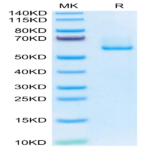 Human EFEMP1 Protein (EFE-HM101)