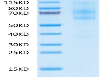 Mouse EFEMP1 Protein (EFE-MM101)