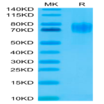 Human EGFRVIII Protein (EG8-HM154)
